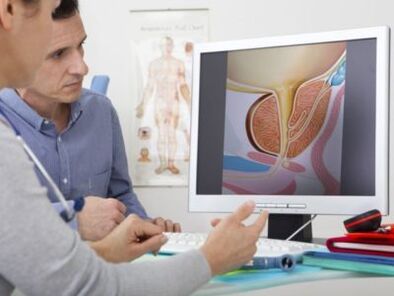 Um urologista consulta um paciente sobre problemas de potência